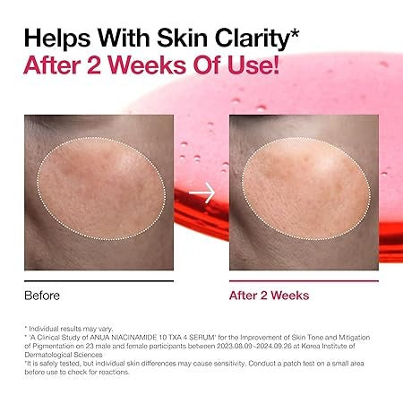 Anua - Niacinamide 10 + TXA 4 Serum