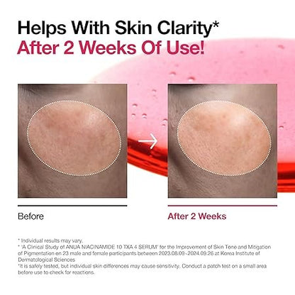 Anua - Niacinamide 10 + TXA 4 Serum