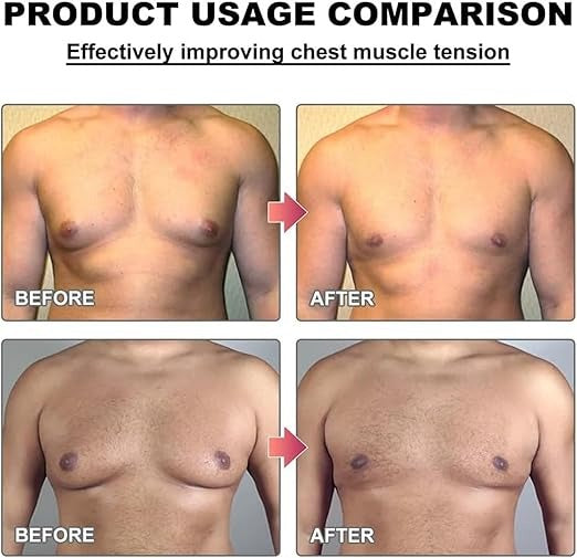 MenTherm Bee Venom Gynecomastia Heating Oil