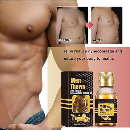 MenTherm Bee Venom Gynecomastia Heating Oil